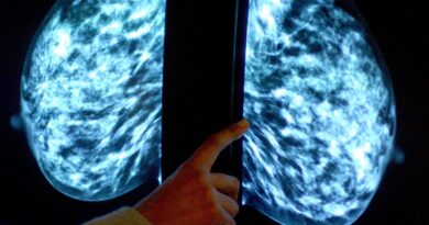 Breast cancer breakthrough: Groundbreaking daily tablet could soon be made available on NHS