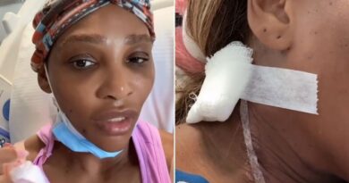 Serena Williams provides health update after surgery to remove ‘lump size of a small grapefruit’