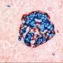 Scientists create functional 3D-printed human islets for type 1 diabetes treatment Scientists create functional 3D-printed human islets for type 1 diabetes treatment