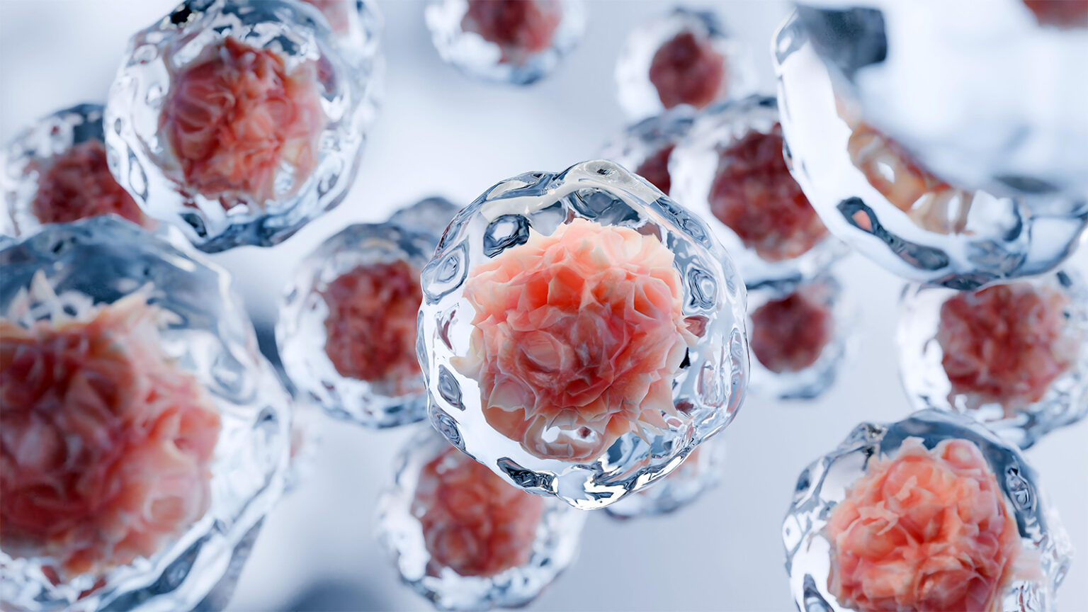 Stem Cell Therapy Begins to Emerge as Potential IBD Treatment Stem Cell Therapy Begins to Emerge as Potential IBD Treatment