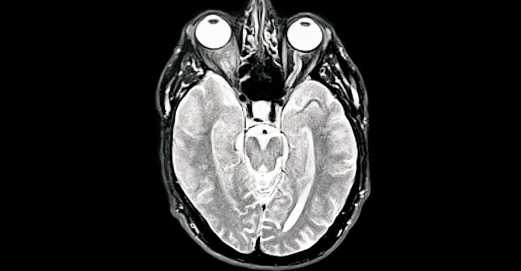 How the fight over what it means to be human has dramatically changed