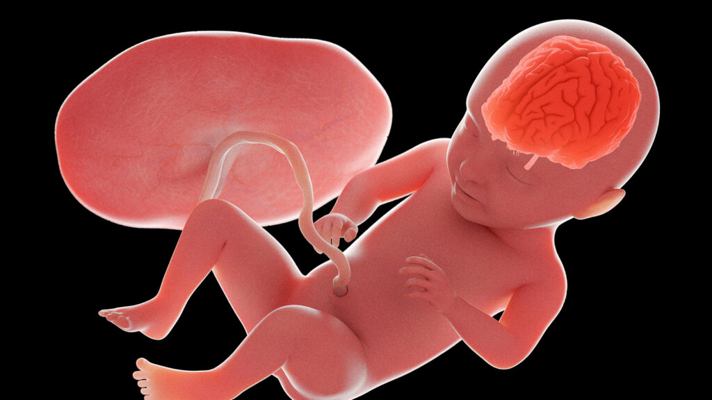 In Utero Treatment for Brain Birth Defect Feasible, Promising
