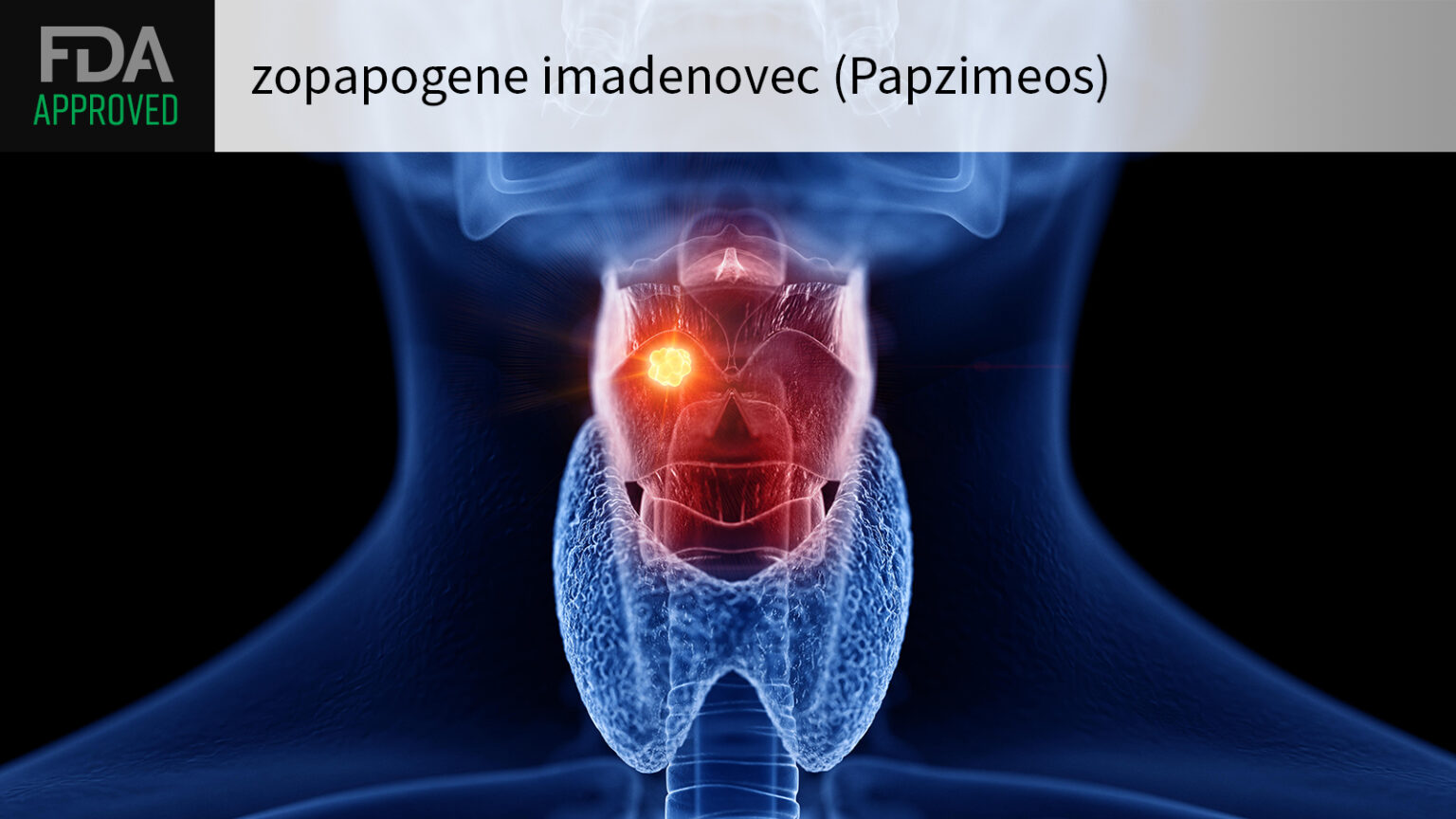 First Therapy Approved for HPV-Related Respiratory Disease