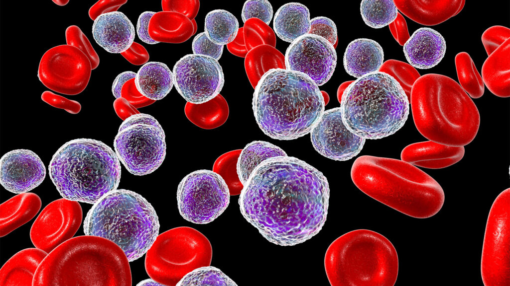 Oral Drug Highly Active in Rare Blood Cancers With FGFR1 Rearrangements