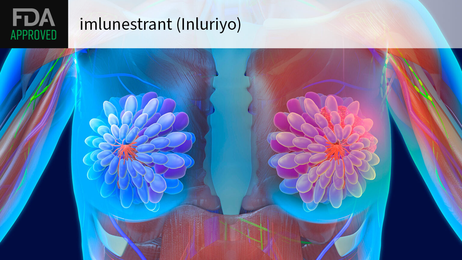 Oral Breast Cancer Drug Wins Broader FDA Nod for ESR1-Mutated Disease