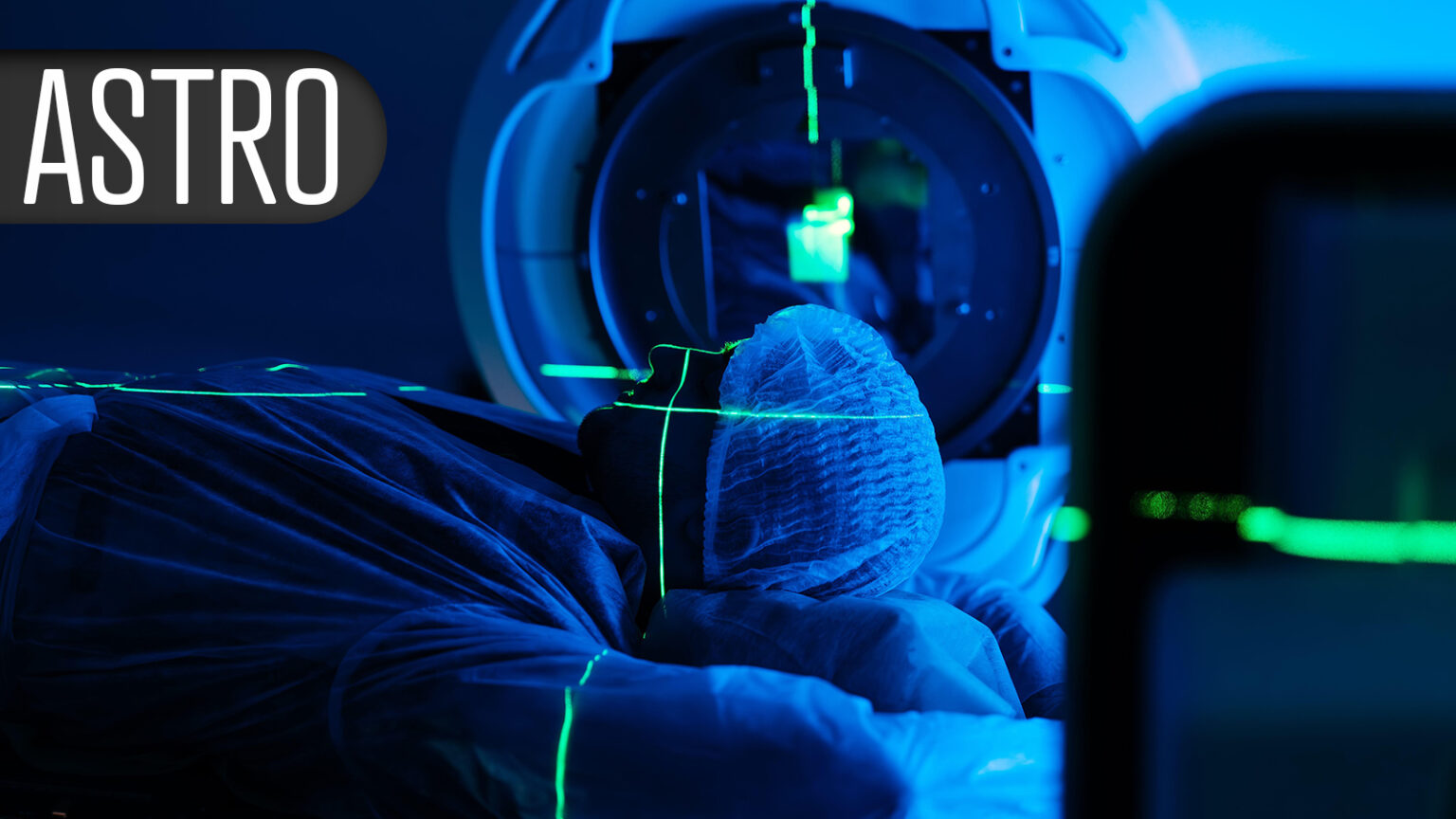 RT Matches Catheter Ablation for Refractory Ventricular Tachycardia, and It’s Safer