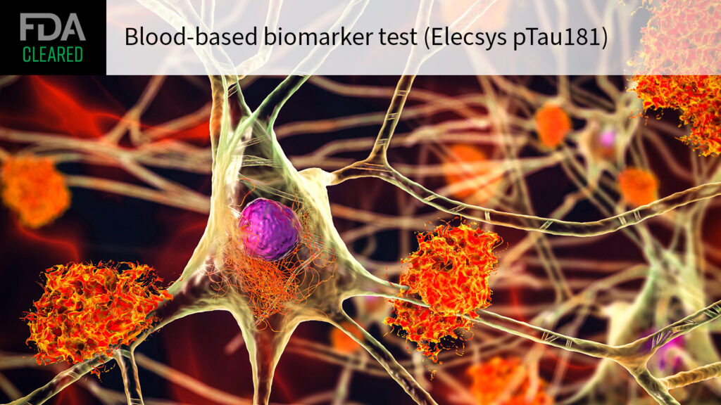 Alzheimer’s Blood Test Cleared for Primary Care Use Alzheimer’s Blood Test Cleared for Primary Care Use