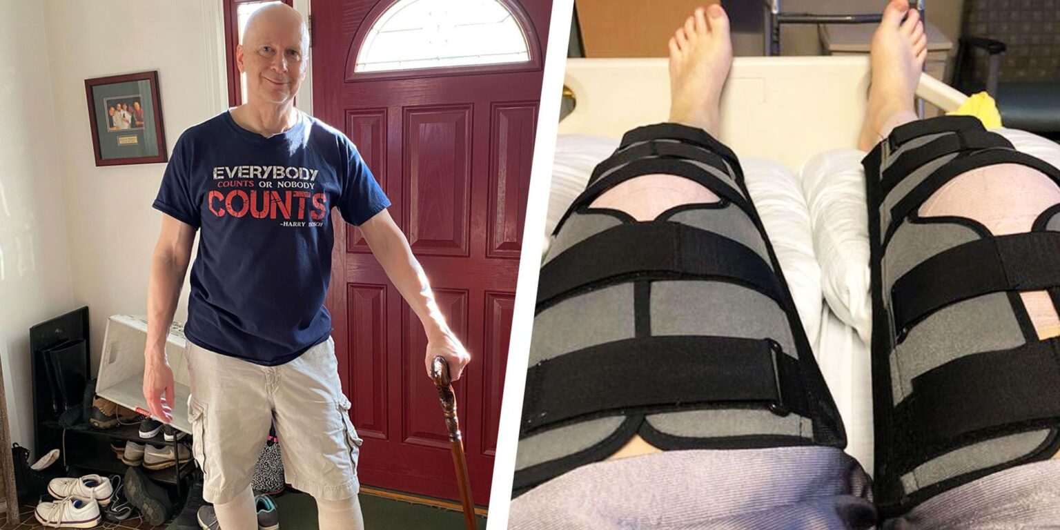 Years of Training Mistakes Caused Me Gruesome Knee Injuries