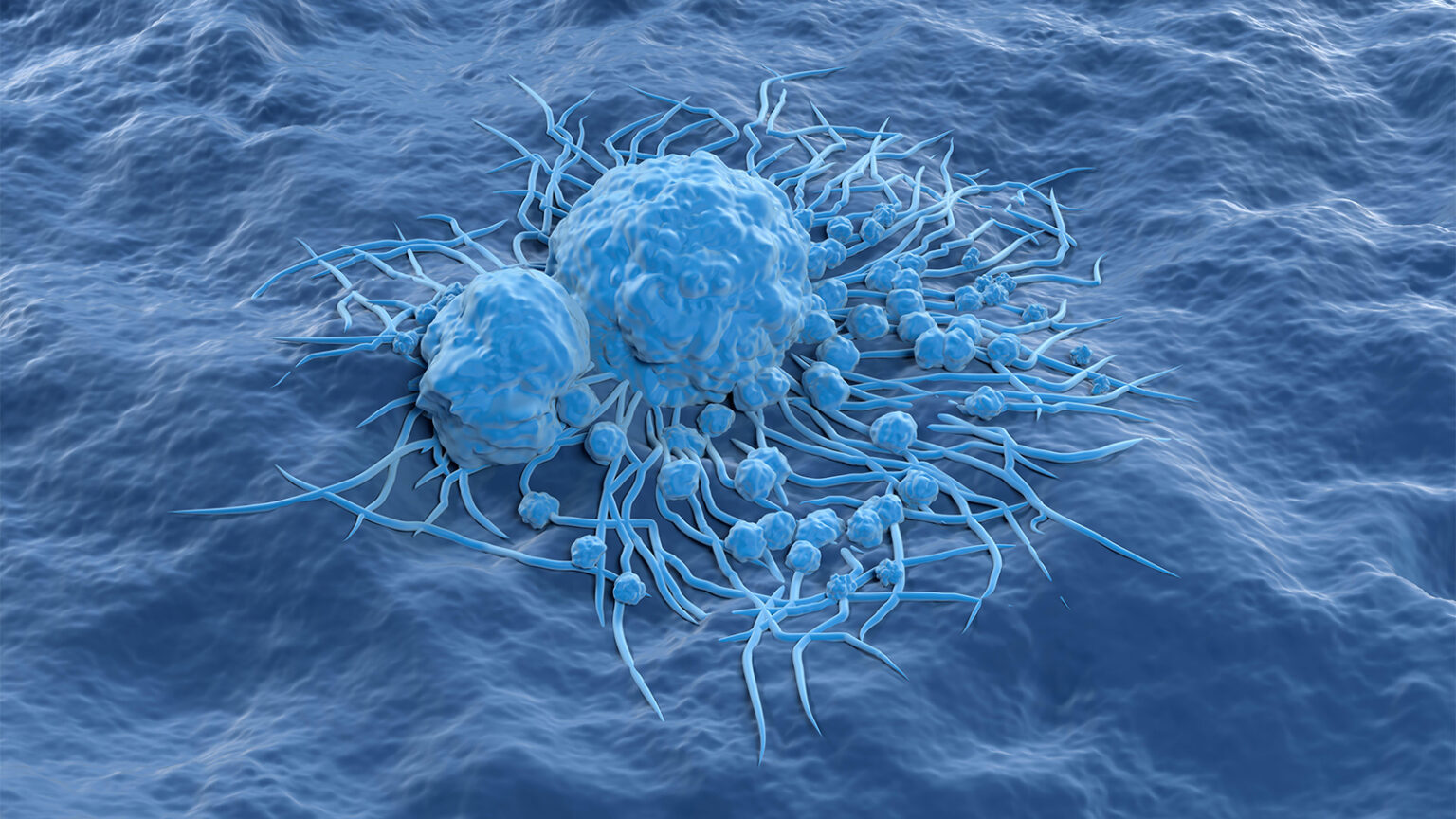 Global Study Reports Rise in Several Cancers Among Adults of All Ages