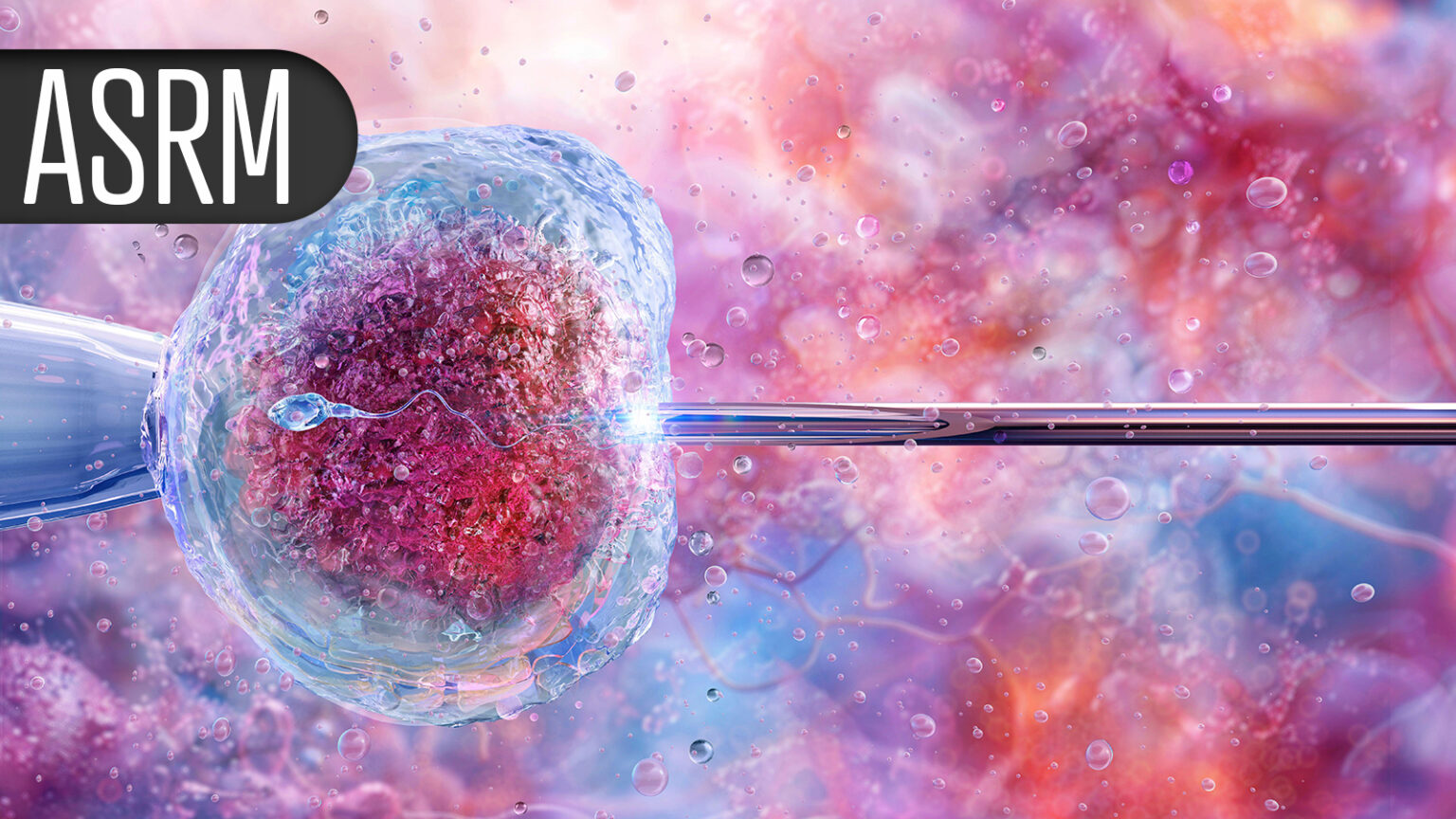 Freezing Eggs ASAP May Boost Chances of Live Birth in Women Over 35