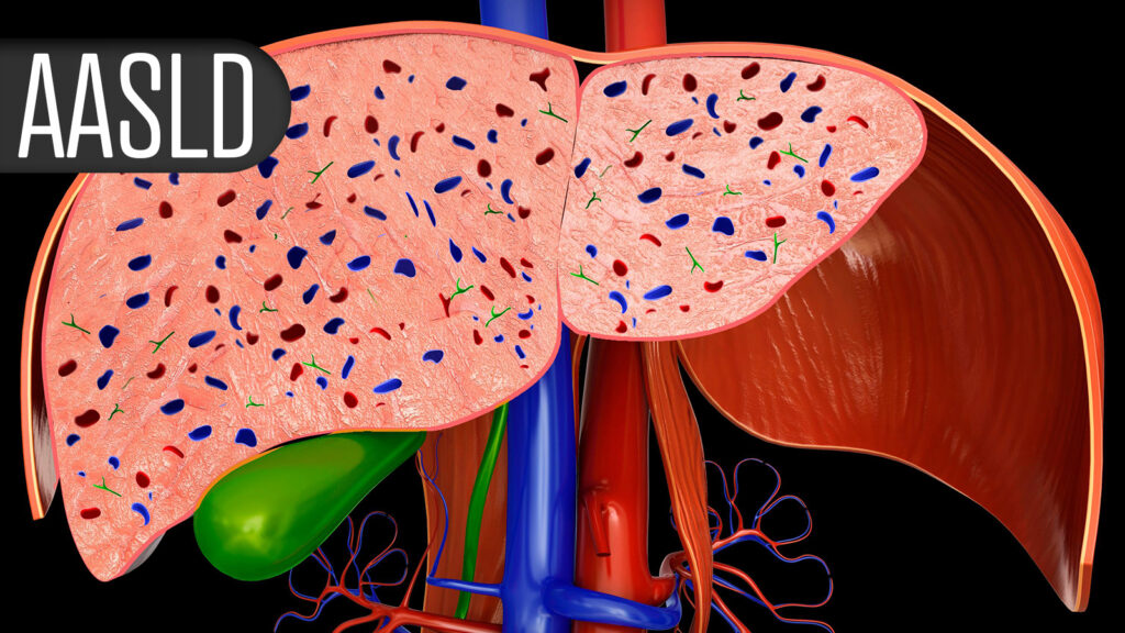 Interim Data Support Elafibranor in Rare Chronic Liver Disease