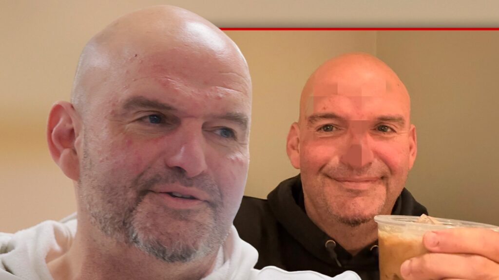 Senator John Fetterman Says He Needed 20 Stitches, Shares Photo of Banged Up Face