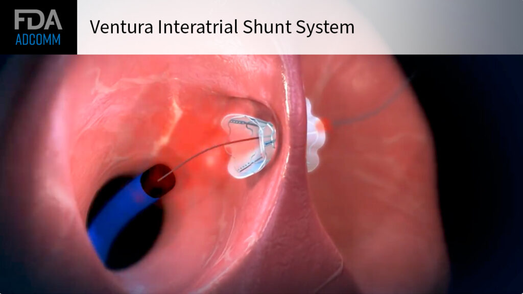 FDA Panel on Interatrial Shunt for Heart Failure: It’s a Hard No