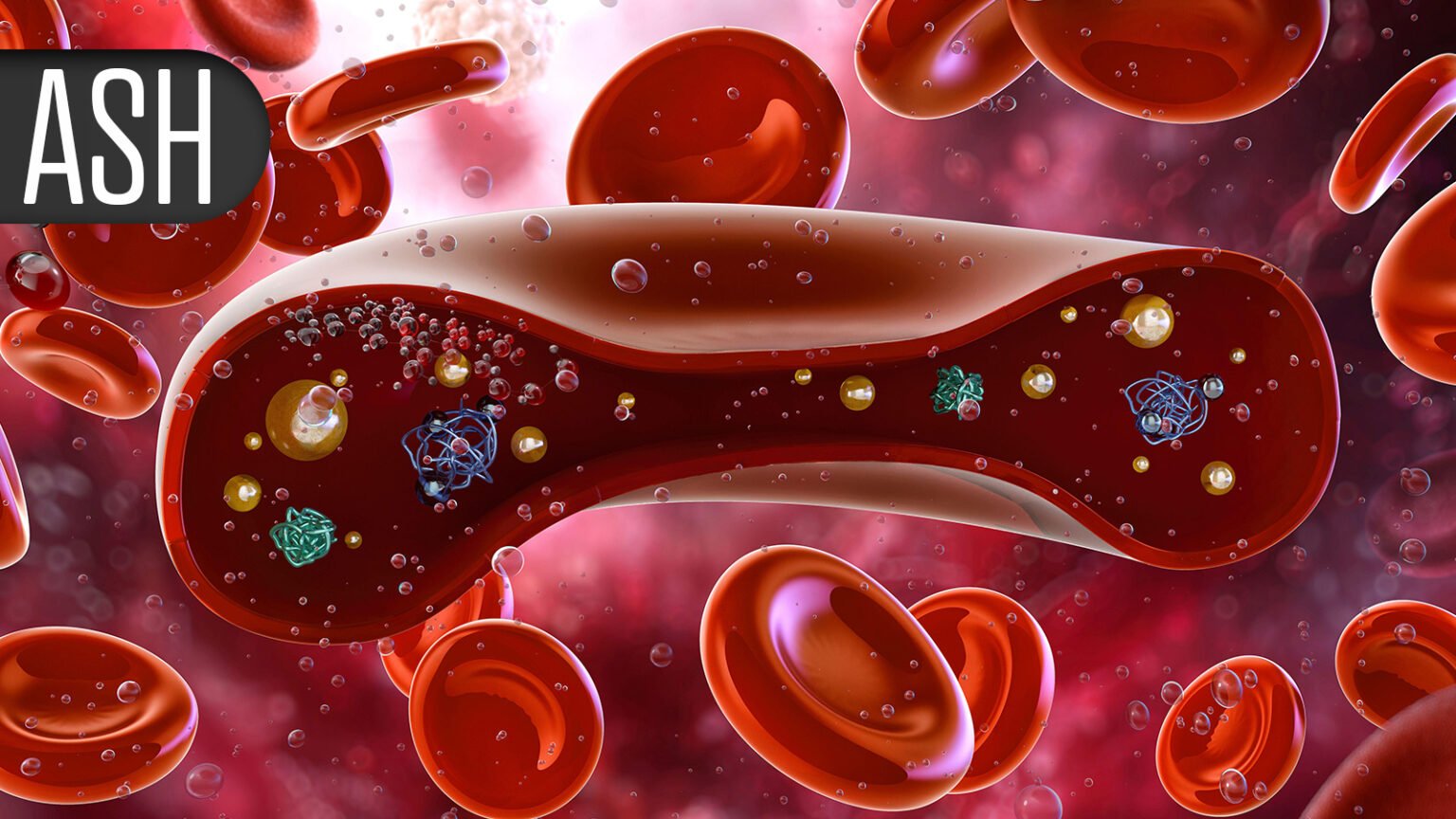 Fixed-Duration or Continuous Therapy in CLL: Trial Says Take Your Pick