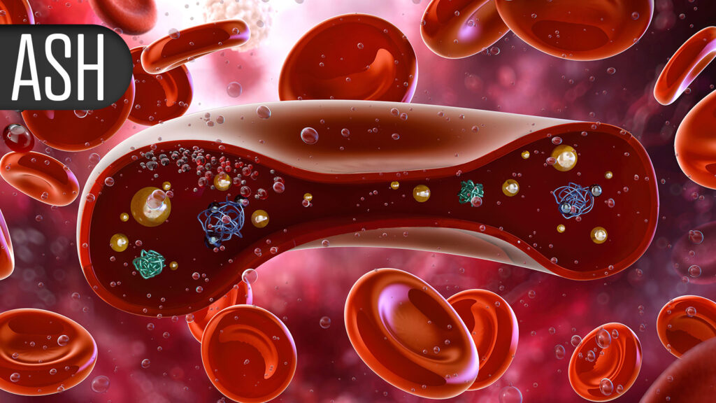 Gene Therapy Also Effective in Younger Children With Inherited Blood Disorders