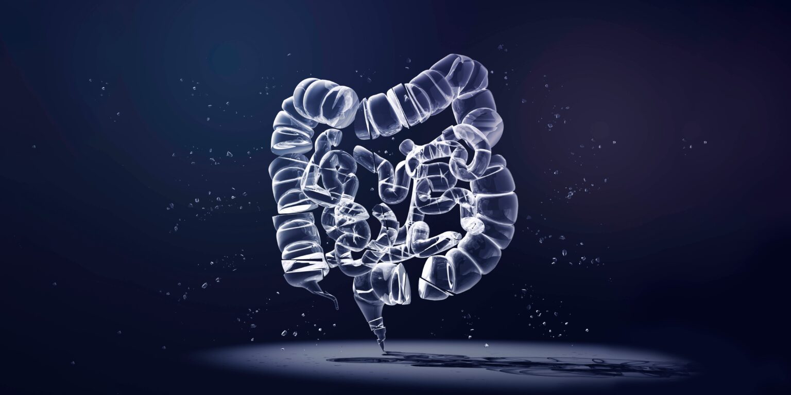 The Race to Find Young-Onset Colorectal Cancer Patients Faster