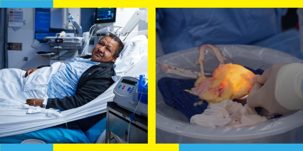 I Survived Bladder and Skin Cancer. My Lifesaver: The World’s first Bladder Transplant.