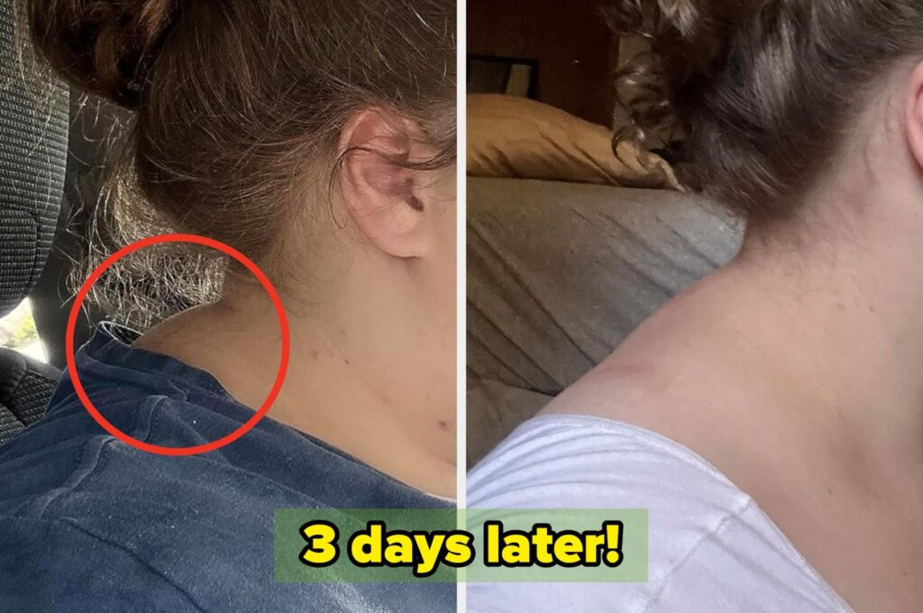 If You Struggle Solving Those Somewhat Obnoxious Personal Care Problems, These 57 Items Will Help You Out