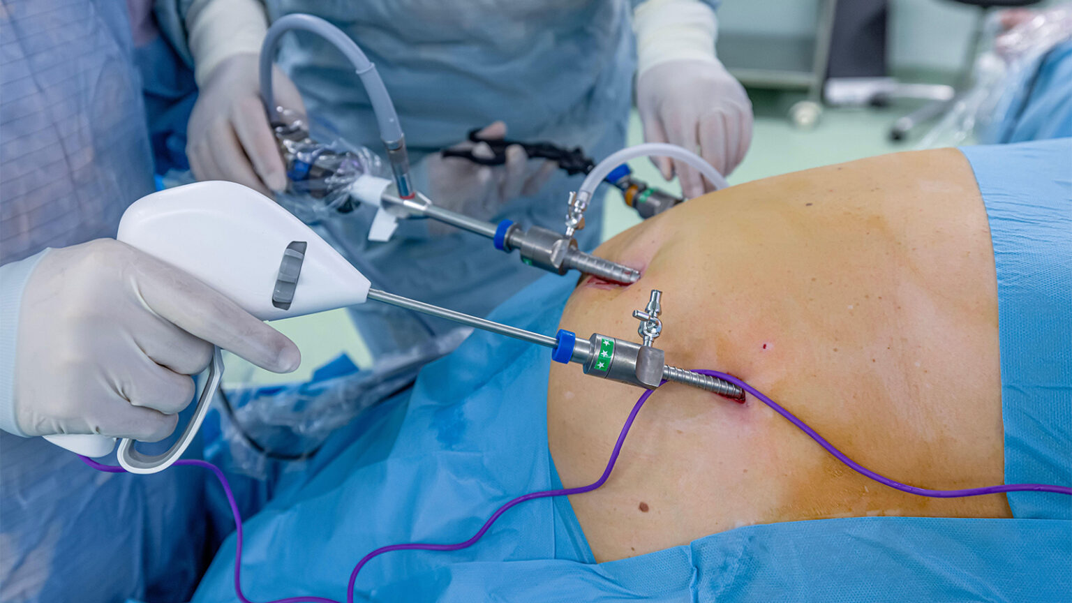 Incretin Therapies After Bariatric Surgery Linked to Lower Risk of Alcohol Disorder