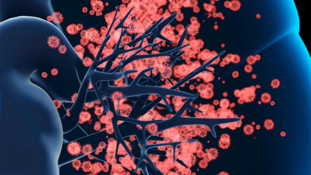 The Ins and Outs of Respiratory Virus Vaccines for Immunocompromised Patients