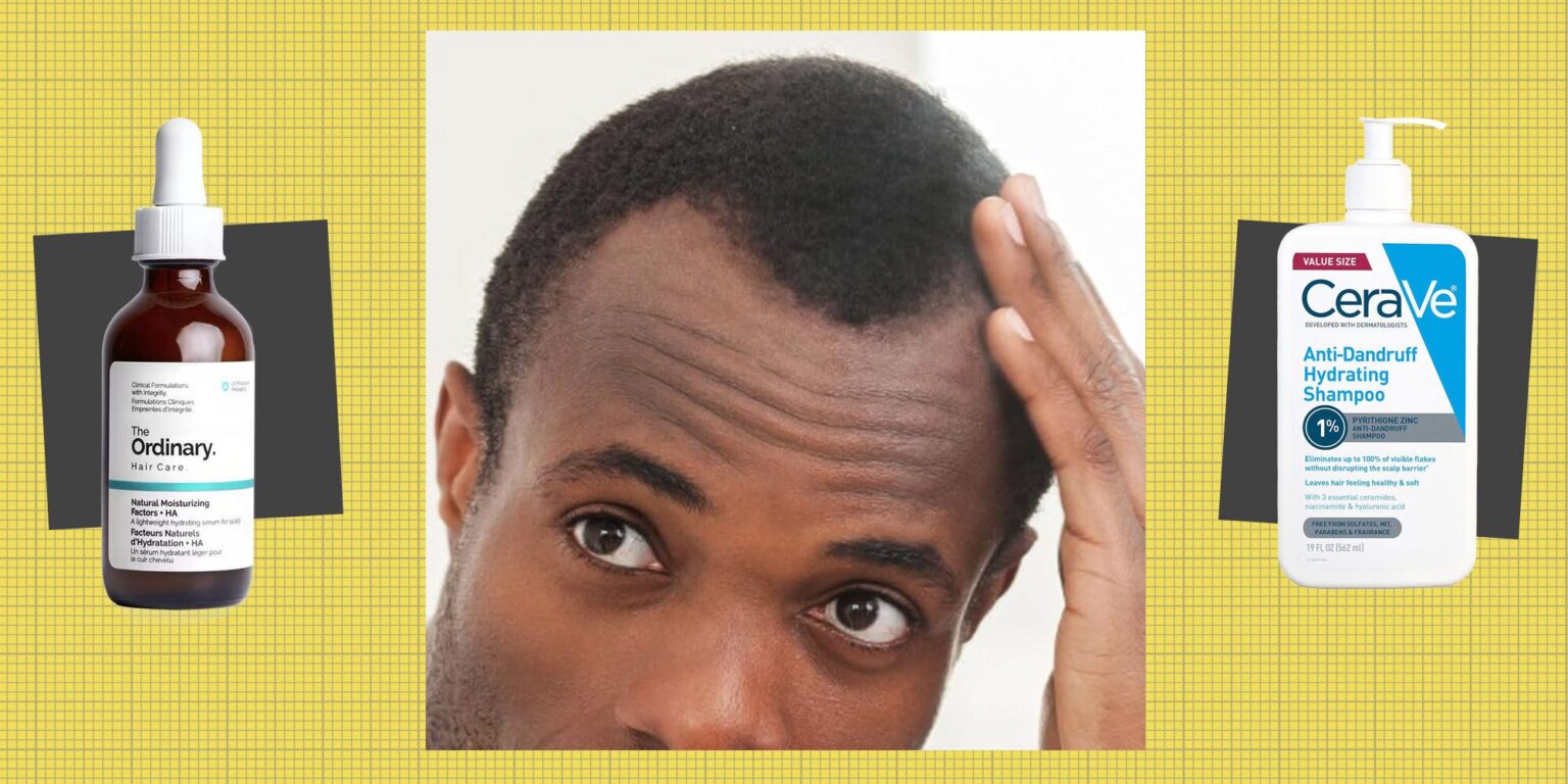 Winter Weather Causing Dry Scalp or Dandruff? Here’s How to Treat Them for Good