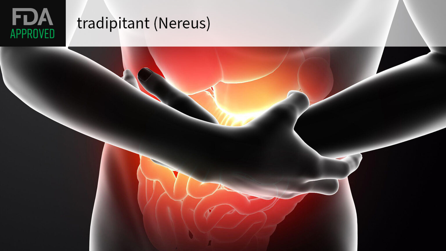 FDA Greenlights First Motion Sickness Drug in More Than 40 Years