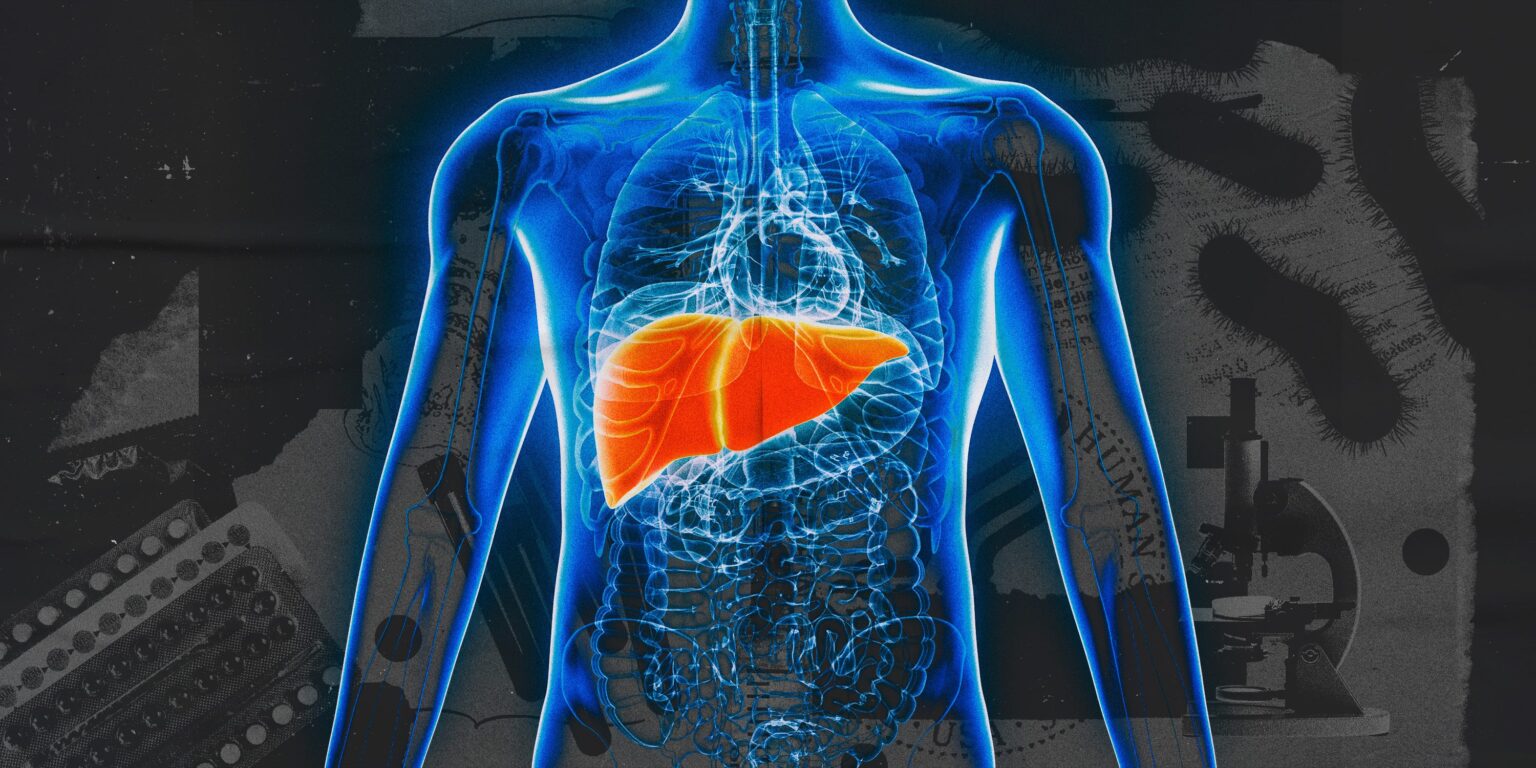 Deleted CDC Page: Prevention Approaches for Viral Hepatitis in Gay and Bisexual Men