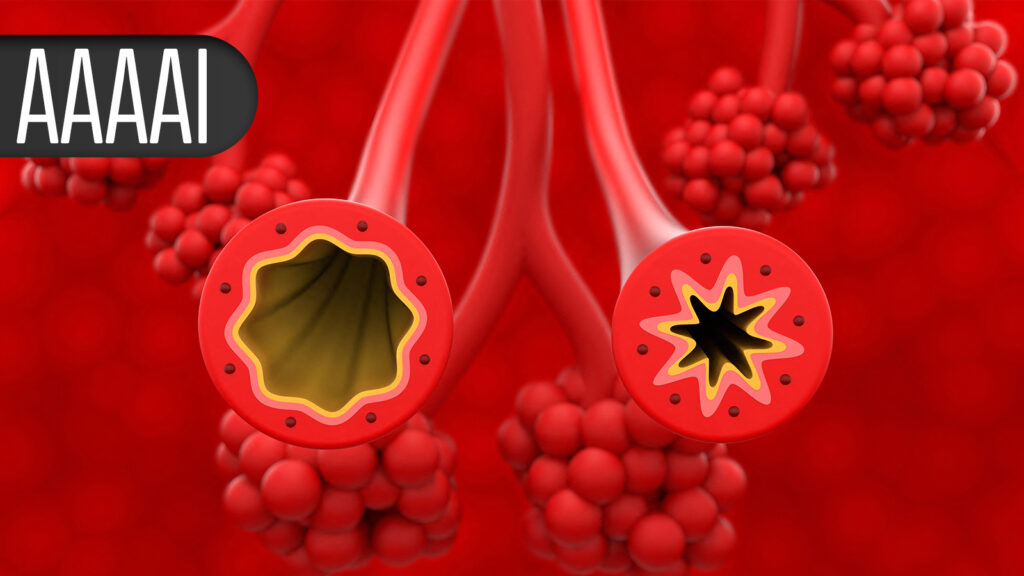 Oral Biologic Shows Promise for Food Allergy Treatment