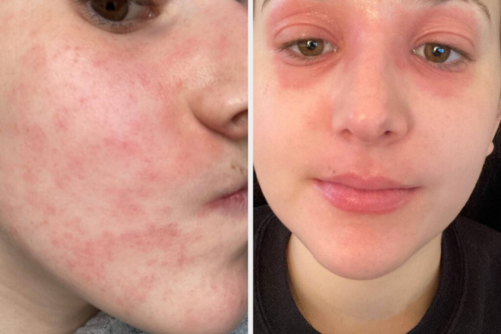 My Skin Freaks Out At Everything, So These 19 Fragrance-Free Products Are My Holy Grails