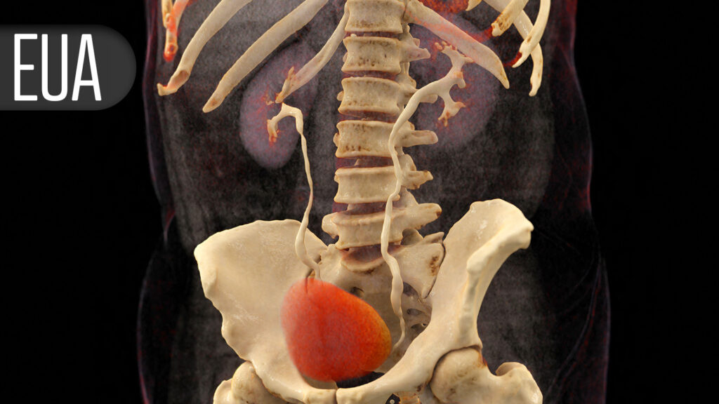PSMA-PET Cuts Need for Biopsy in Suspected Prostate Cancer