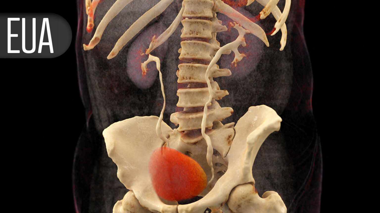 PSMA-PET Cuts Need for Biopsy in Suspected Prostate Cancer