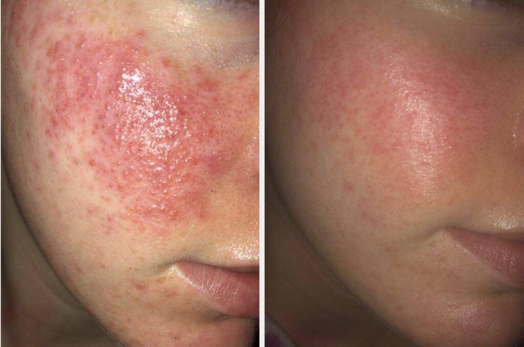 “Future You” Will Thank You For Adding These 27 Magical Skincare Products Into Your Routine *Now*