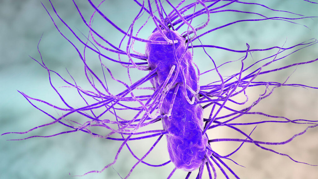 Dementia Risk Rises After Severe Infection