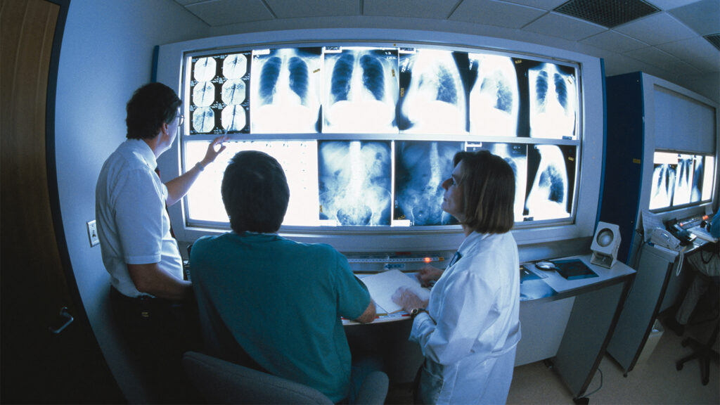 Deepfake X-Rays Sneak Past Radiologists and AI, Underscoring Abuse Potential