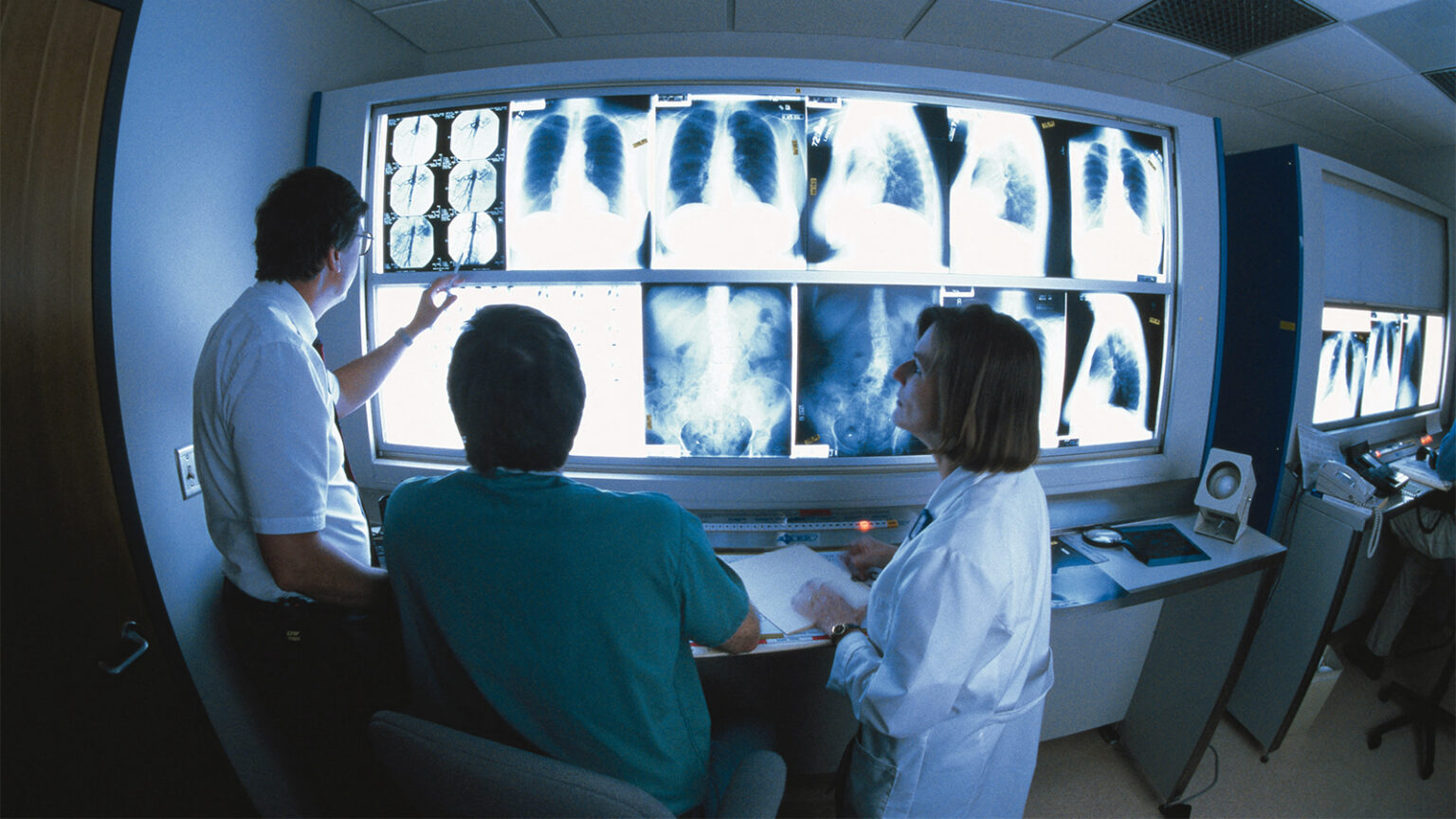 Deepfake X-Rays Sneak Past Radiologists and AI, Underscoring Abuse Potential