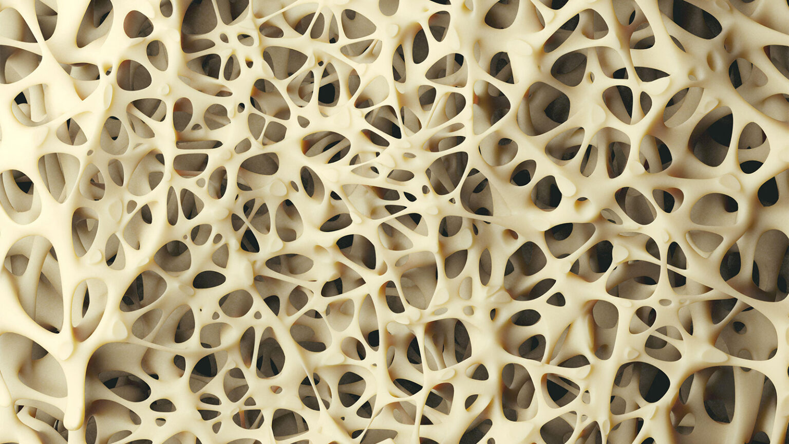 Can a Steroid Swap Protect Bone Health in Adrenal Insufficiency?