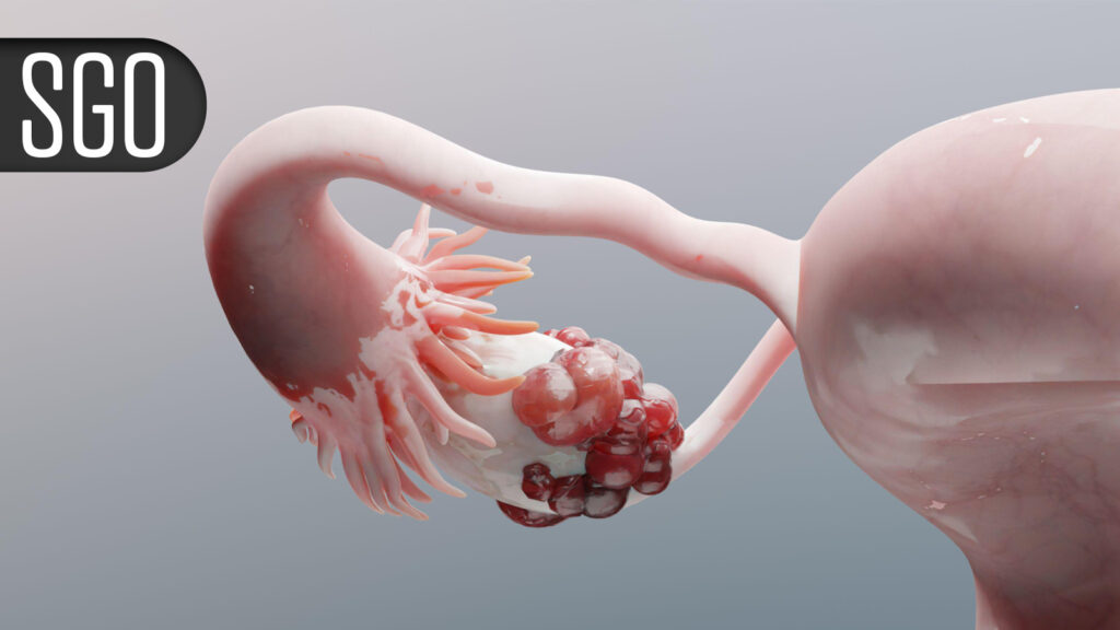 Encouraging Activity in Poor-Risk Endometrial Cancer With HER2-Targeted Novel Drug