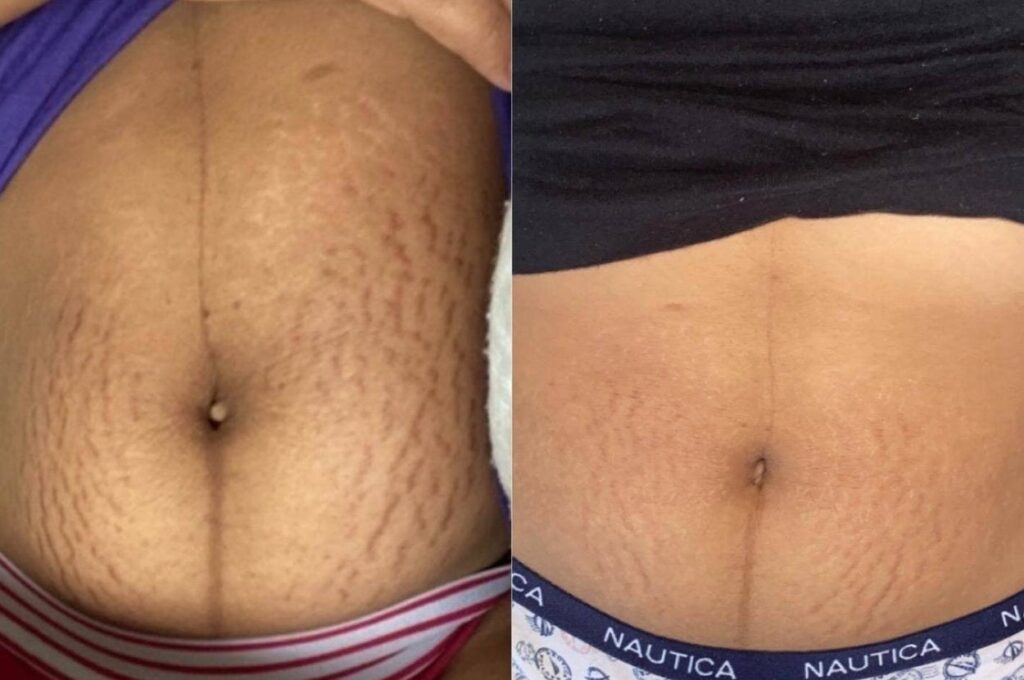 32 Products To Help Solve The Grooming Issues You Wish Would Disappear 32 Products To Help Solve The Grooming Issues You Wish Would Disappear