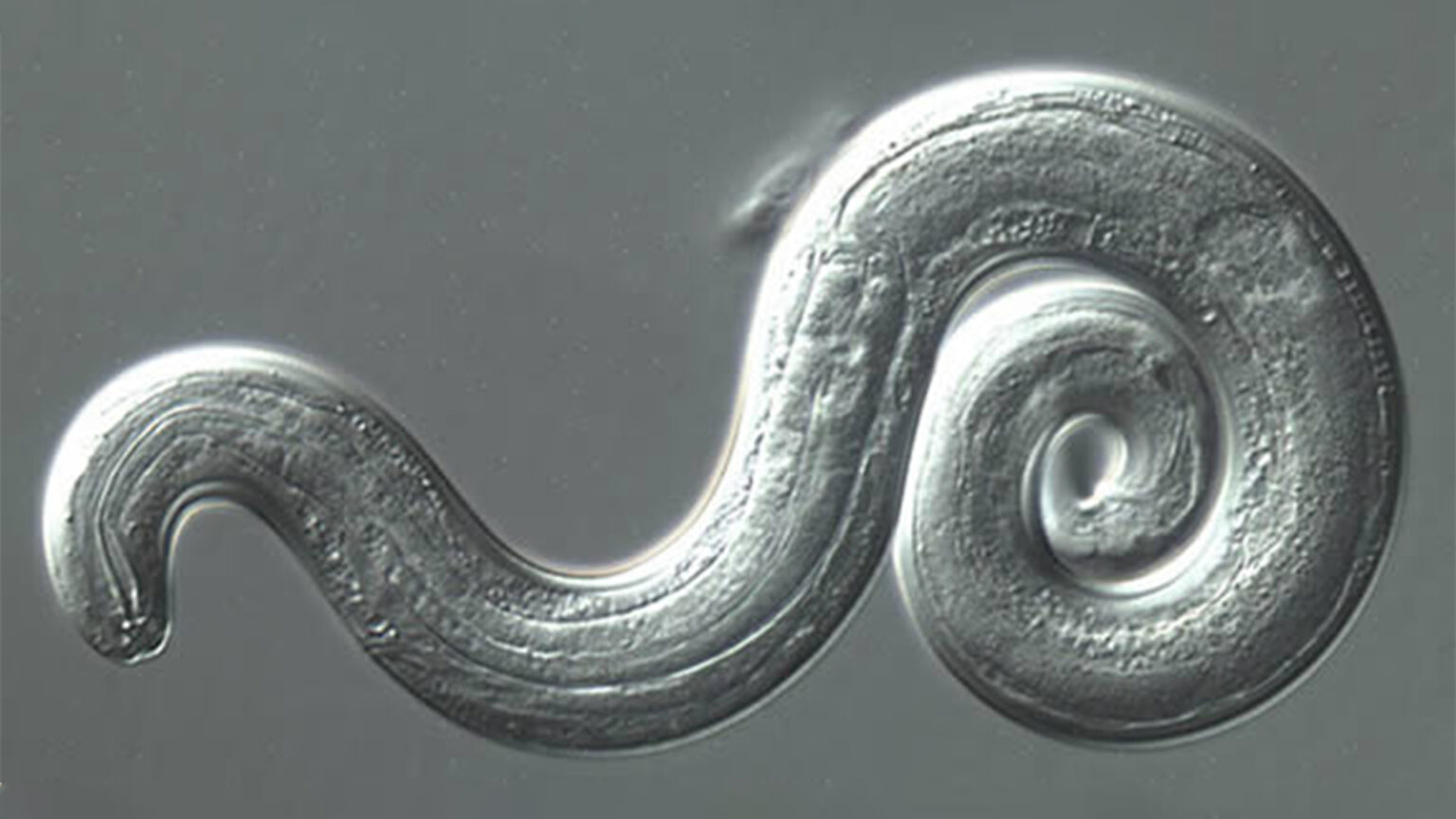 Rat Lungworm Is Now in My State. Is It in Yours Too?