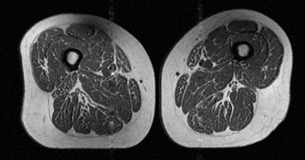 Alarming image exposes effect ultra-processed foods have on bodies…