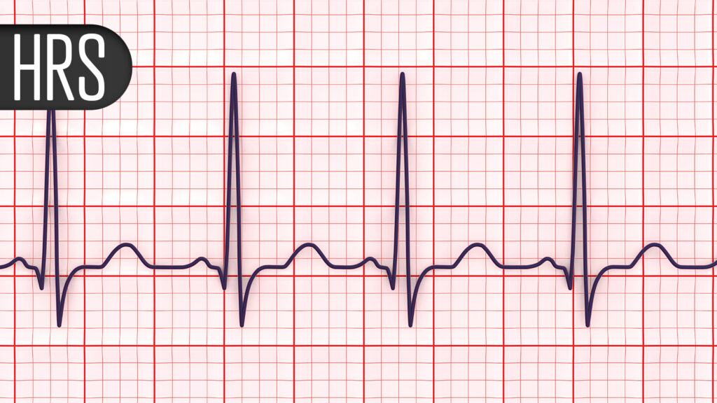 Think Heart Attacks Cause Most Sudden Cardiac Deaths? Think Again, Study Says