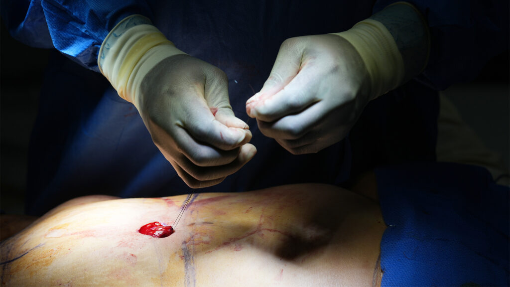 Cosmetic Interventions Are Booming. Many Say Ethical Conversations Are Lagging.