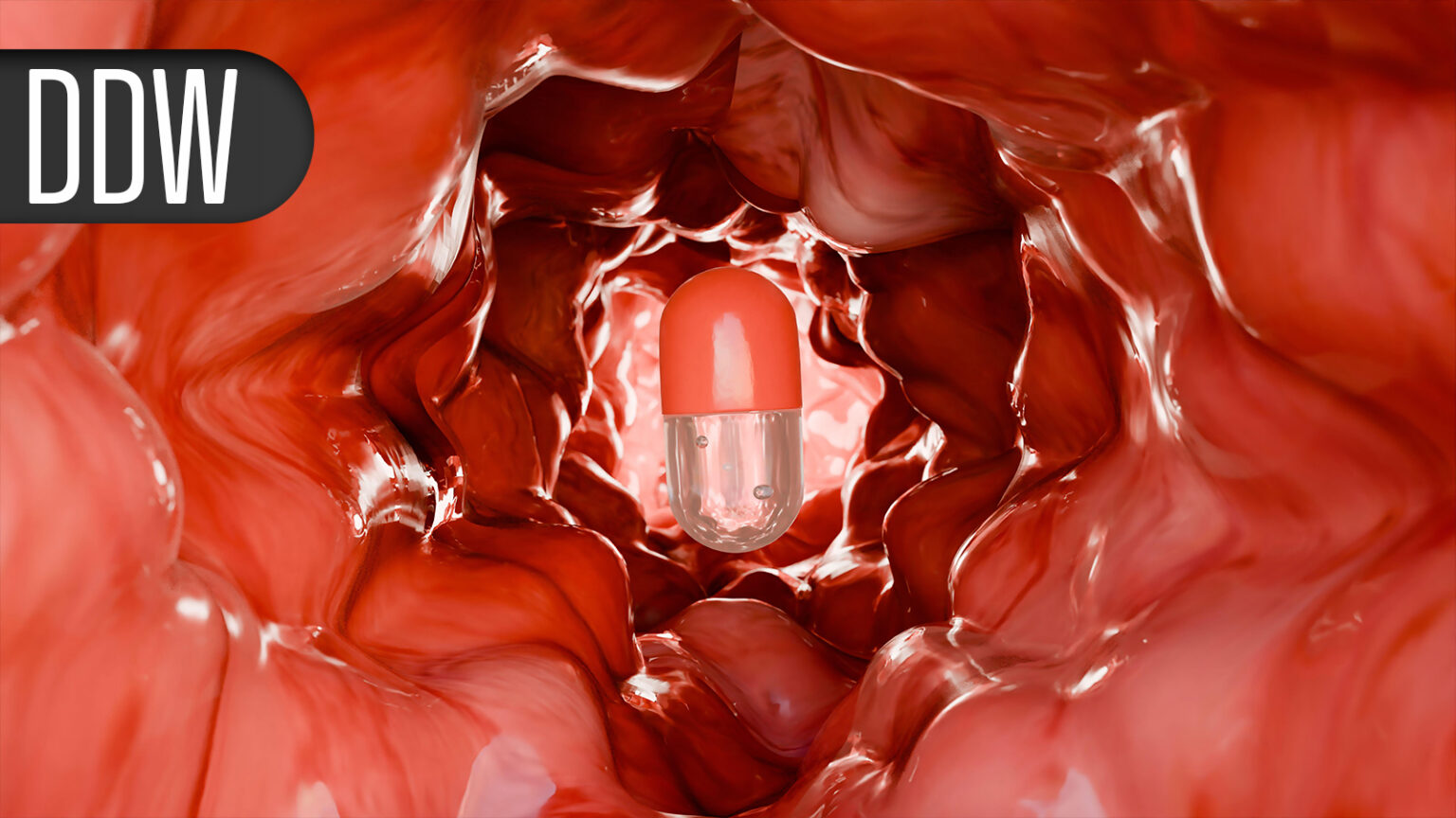 Less Invasive Treatment Option for GERD May Offer Similar Results to Gold Standard