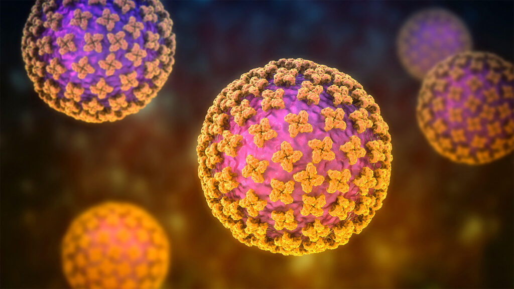 More Americans Being Monitored for Hantavirus Than Previously Known