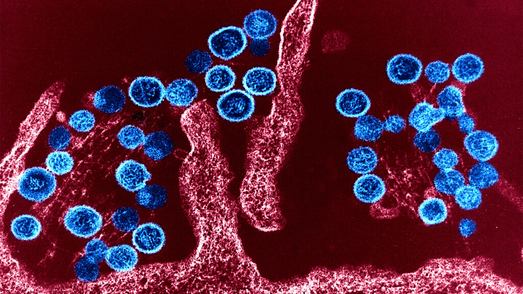 Hantavirus Strain in Outbreak Hasn’t Become More Transmissible, WHO Says