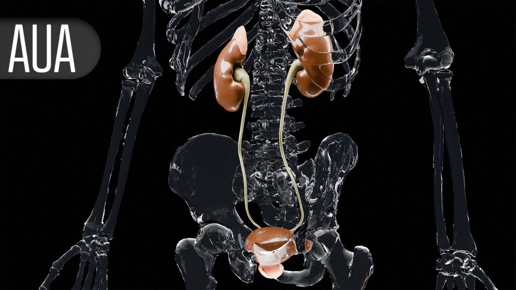 Half of Patients With Post-BCG Bladder Cancer Achieve CR With Nonviral Gene Therapy