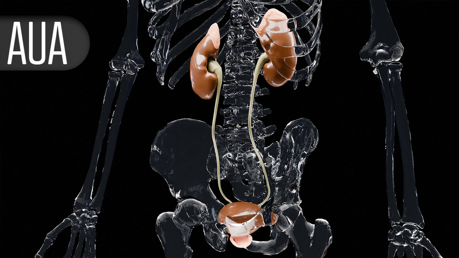 Too Much or Too Little Opioid Pain Relief May Drive Refills After Urologic Surgery