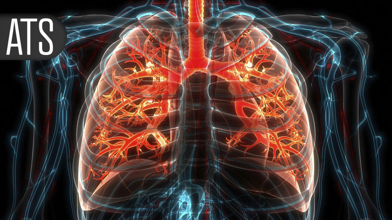Whole Blood Not Better Than Components En Route to Hospital After Traumatic Injury
