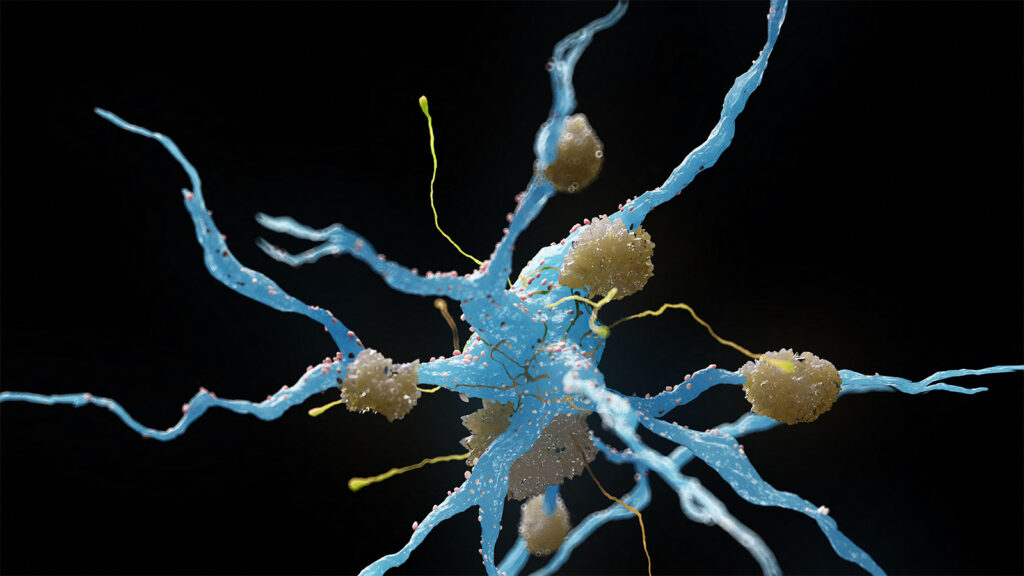Study Questions Methods Used in Alzheimer’s Drug Analysis