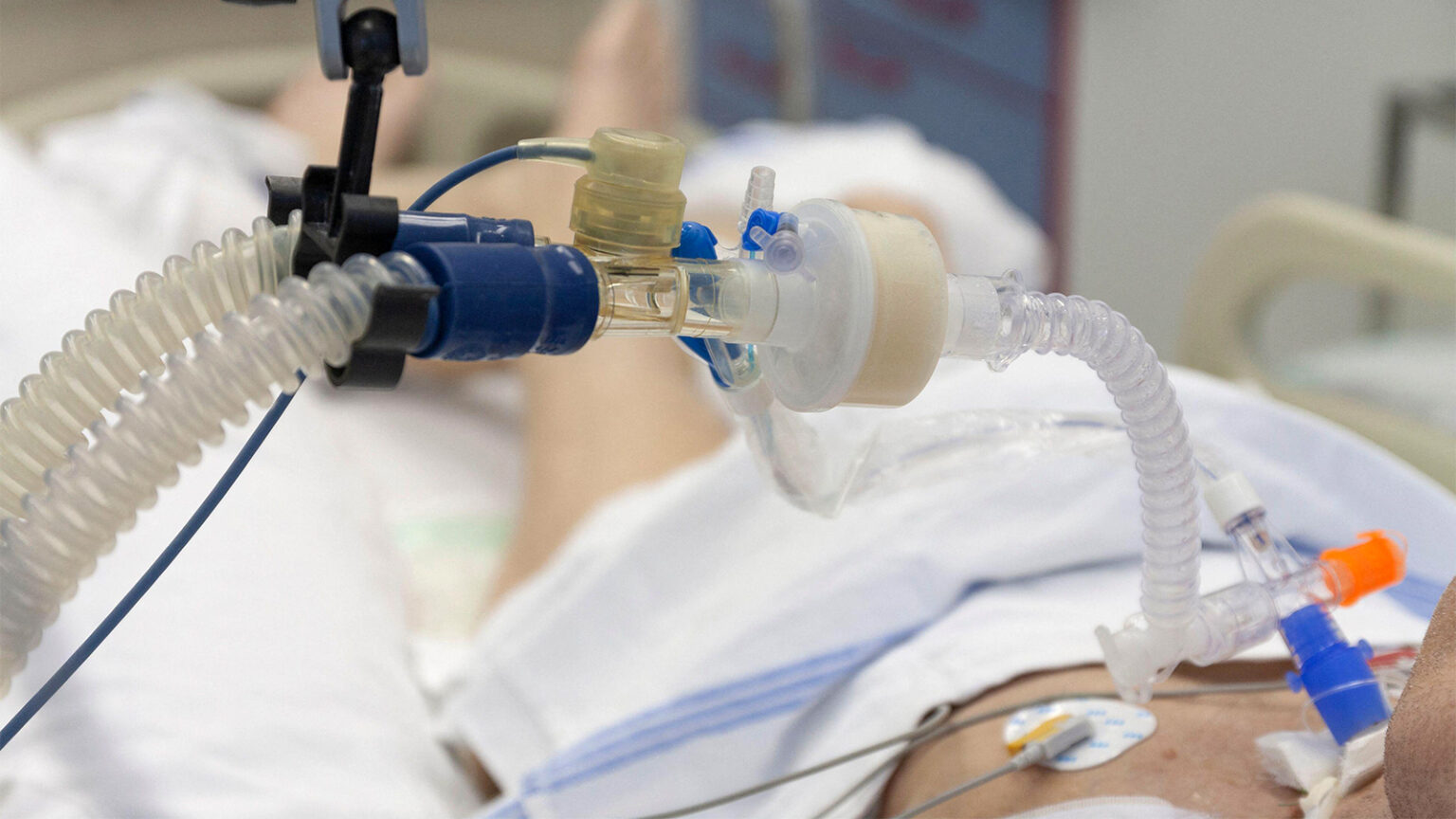 Mucus Thinners Yield Troubling Results for Ventilated ICU Patients